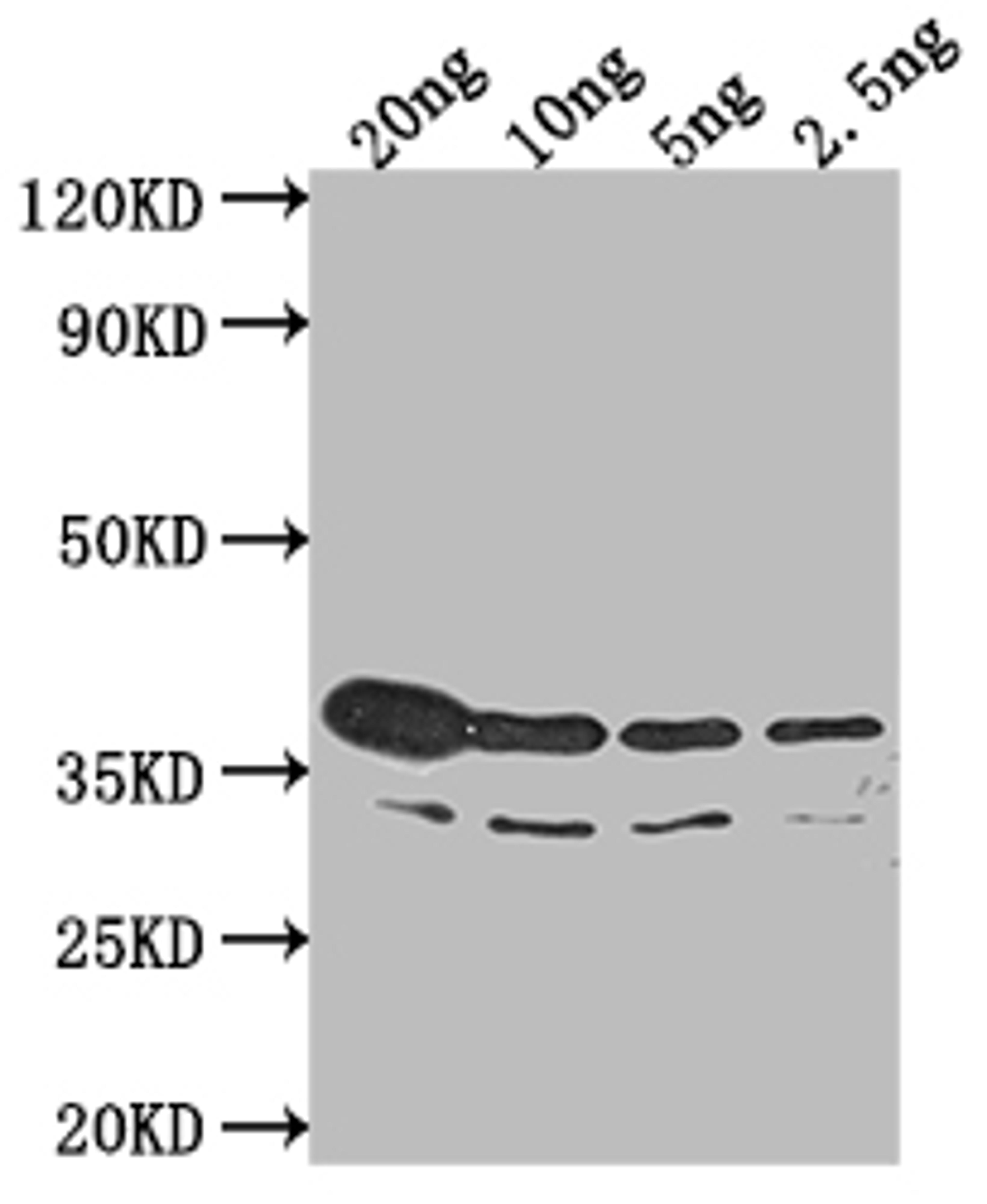 Western Blot. Positive WB detected in Recombinant protein. All lanes: btuB antibody at 1:2000. Secondary. Goat polyclonal to rabbit IgG at 1/50000 dilution. Predicted band size: 36.3 kDa. Observed band size: 42 kDa. 