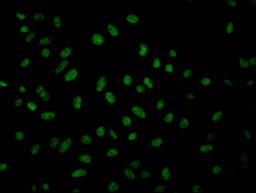 Immunofluorescence staining of Hela Cells with CSB-RA585624A0HU at 1:50, counter-stained with DAPI. The cells were fixed in 4% formaldehyde, permeated by 0.2% TritonX-100, and blocked in 10% normal Goat Serum. The cells were then incubated with the antibody overnight at 4℃. Nuclear DNA was labeled in blue with DAPI. The secondary antibody was FITC-conjugated AffiniPure Goat Anti-Rabbit IgG (H+L).