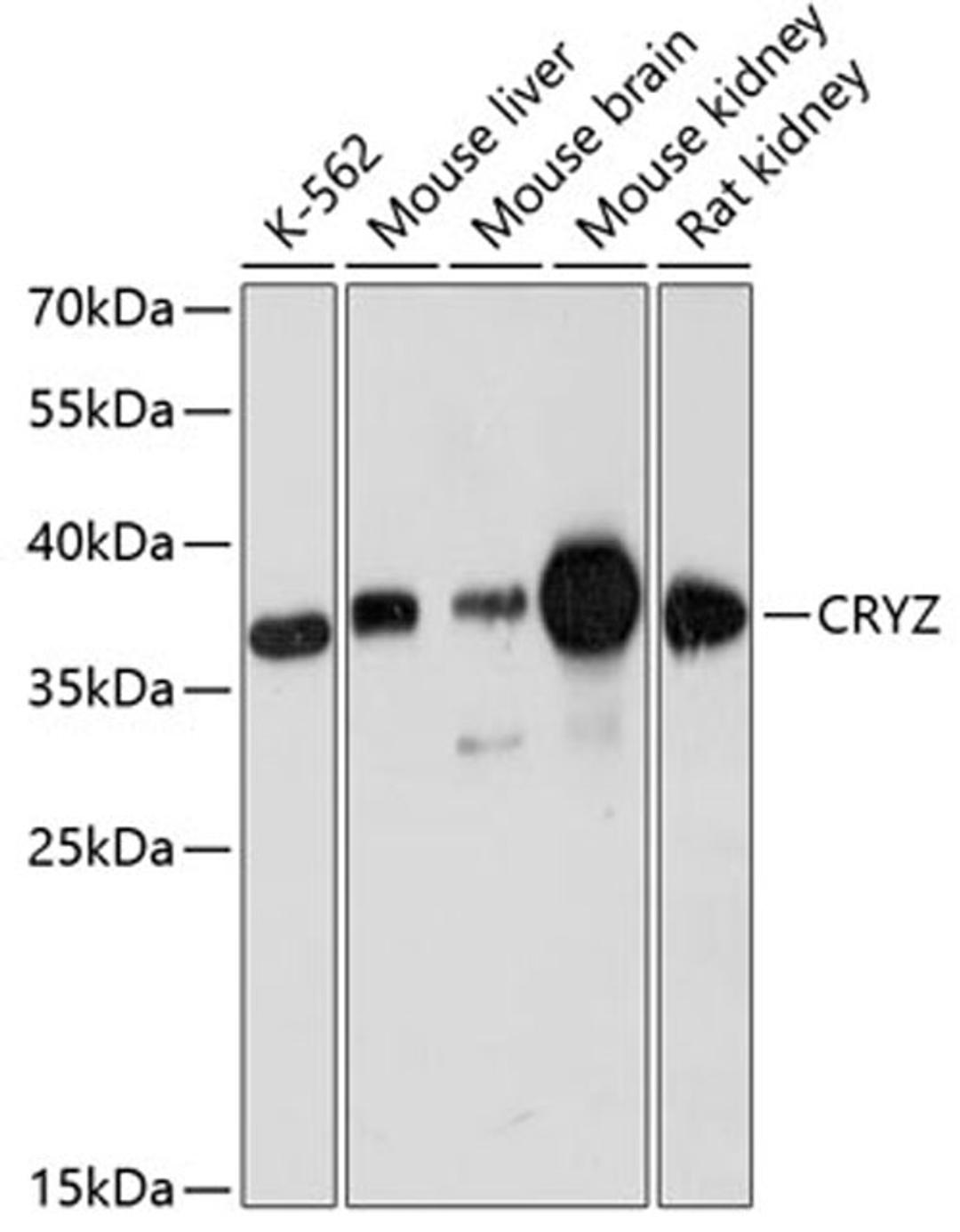 Western blot - CRYZ antibody (A12857)