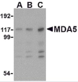 Western blot analysis of MDA5 in Daudi cell lysate with MDA5 antibody at (A) 1, (B) 2 and (C) 4 &#956;g/mL.