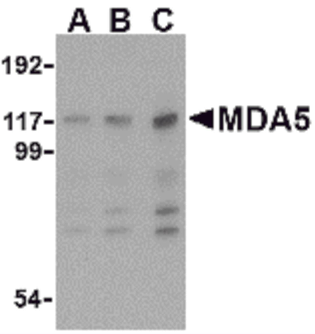 Western blot analysis of MDA5 in Daudi cell lysate with MDA5 antibody at (A) 1, (B) 2 and (C) 4 μg/mL.