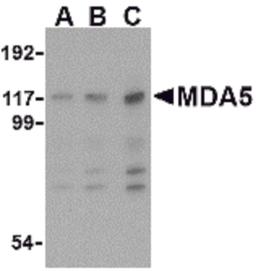 Western blot analysis of MDA5 in Daudi cell lysate with MDA5 antibody at (A) 1, (B) 2 and (C) 4 μg/mL.