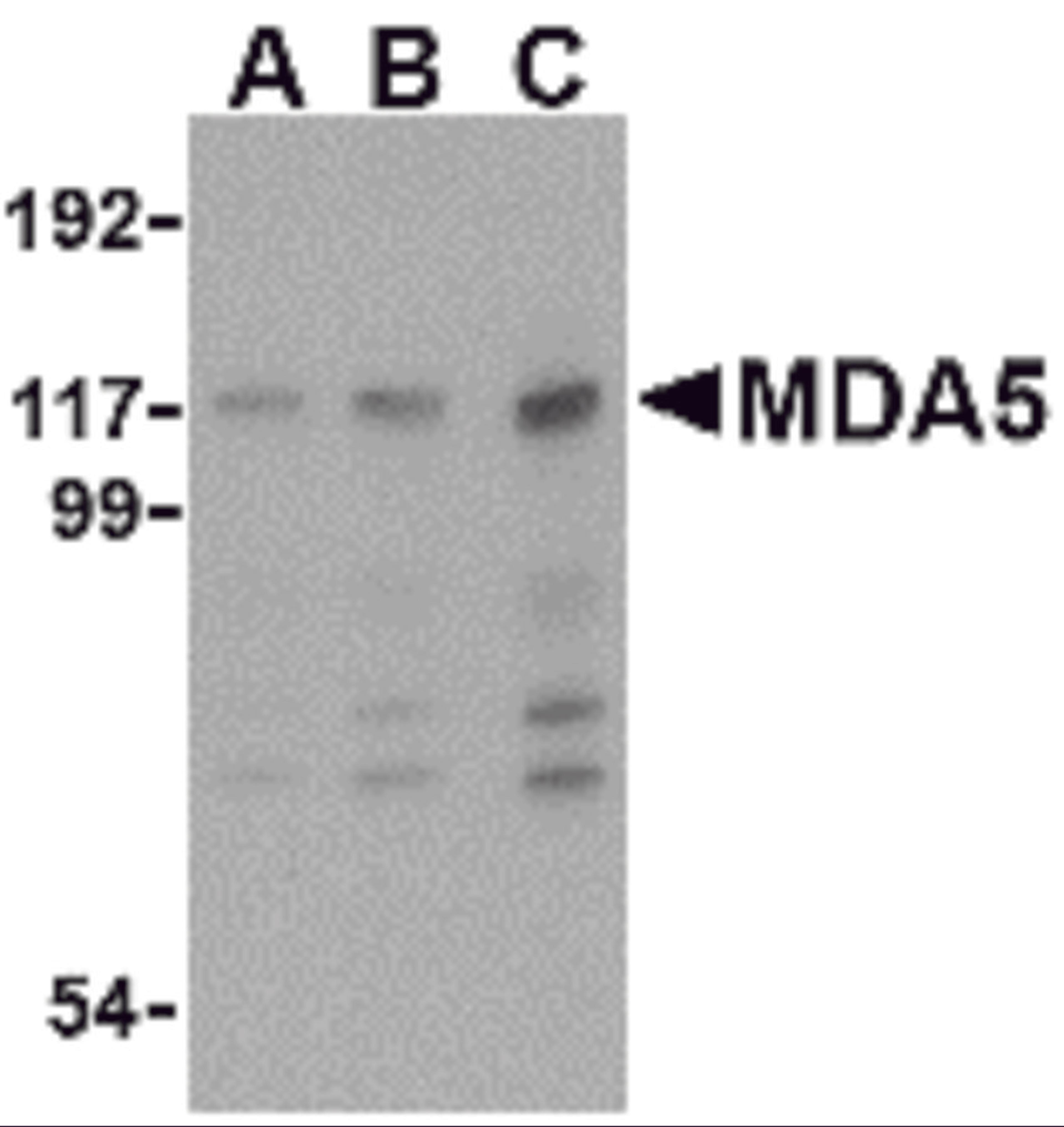 Western blot analysis of MDA5 in Daudi cell lysate with MDA5 antibody at (A) 1, (B) 2 and (C) 4 μg/mL.