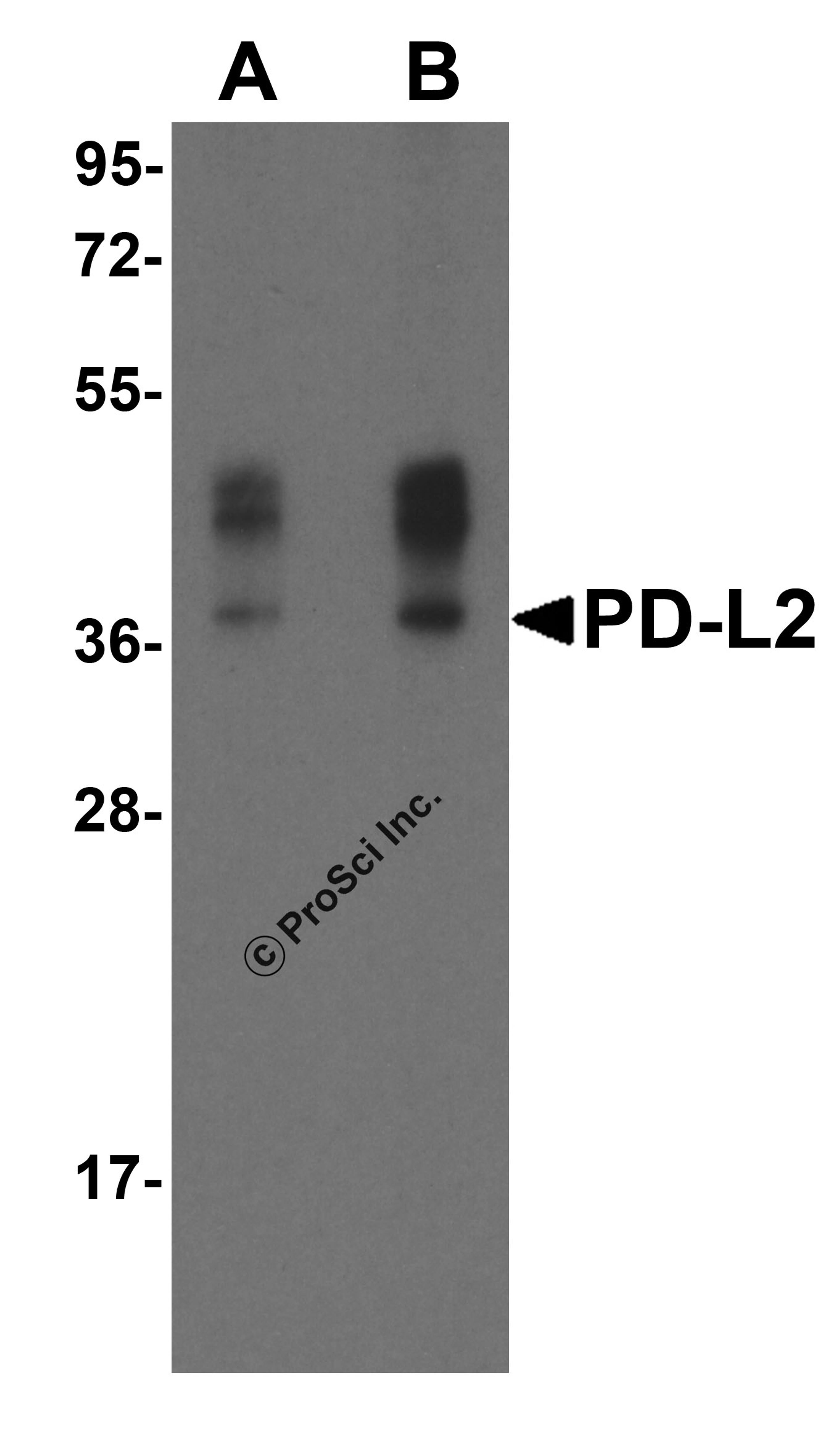 Western blot analysis of PD-L2 in overexpressing HEK293 cells PD-L2 antibody at 0.5 and 1 &#956;g/ml