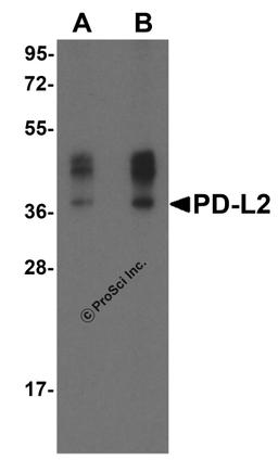 Western blot analysis of PD-L2 in overexpressing HEK293 cells PD-L2 antibody at 0.5 and 1 μg/ml