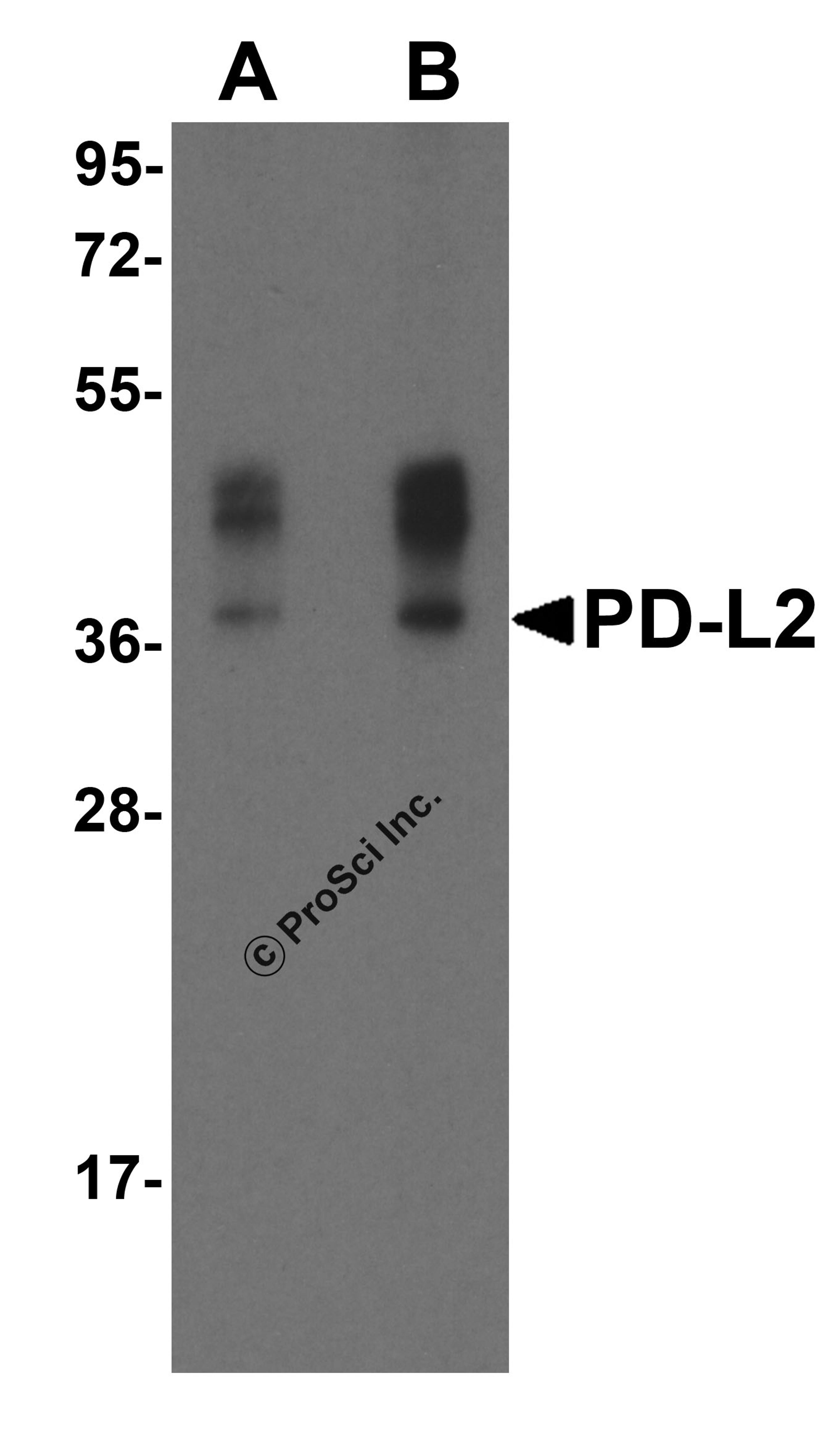 Western blot analysis of PD-L2 in overexpressing HEK293 cells PD-L2 antibody at 0.5 and 1 μg/ml