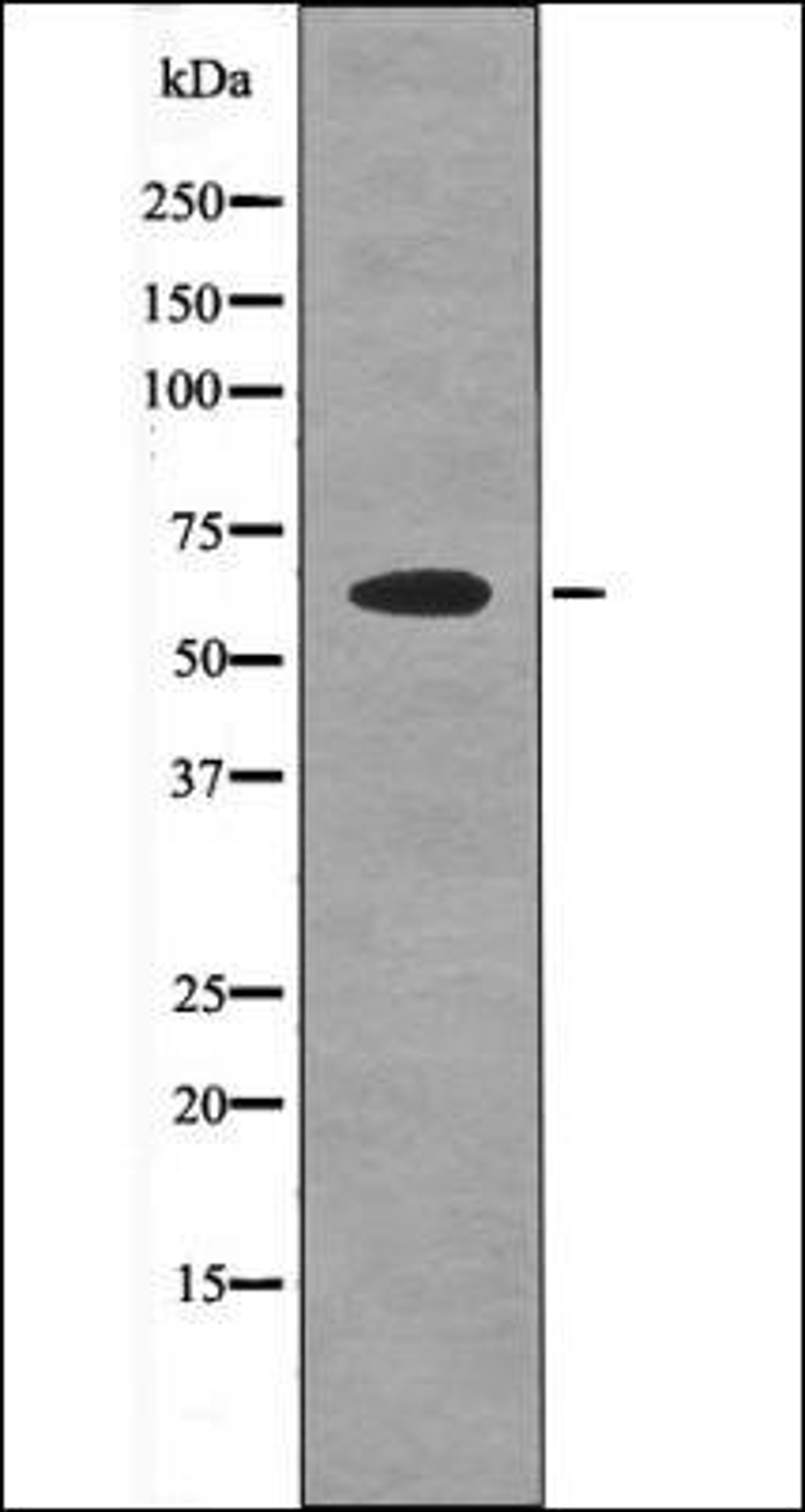 Western blot analysis of COLO205 whole cell lysates using PDK1 -Phospho-Tyr376- antibody