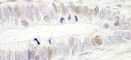 Detection of human USP10 by immunohistochemistry.