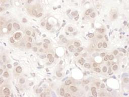 Detection of human REST by immunohistochemistry.