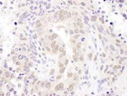 Detection of mouse HEXIM1 by immunohistochemistry.