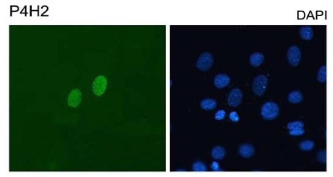 Immunocytochemistry/Immunofluorescence: DUX4 Antibody (P4H2) [NBP1-49552] - Detection of human DUX4 on C2C12 mouse myoblasts transfected with pCS2-DUX4. Cells were counterstained with DAPI for nuclei.