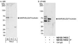 Western Blot: MARVELD2 Antibody [NB100-74633] - Detection of Human MARVELD2/Tricellulinon HeLa whole cell lysate using NB100-74633. MARVELD2/Tricellulin was also immunoprecipitated by rabbit anti-MARVELD2/Tricellulin antibody NB100-74632.