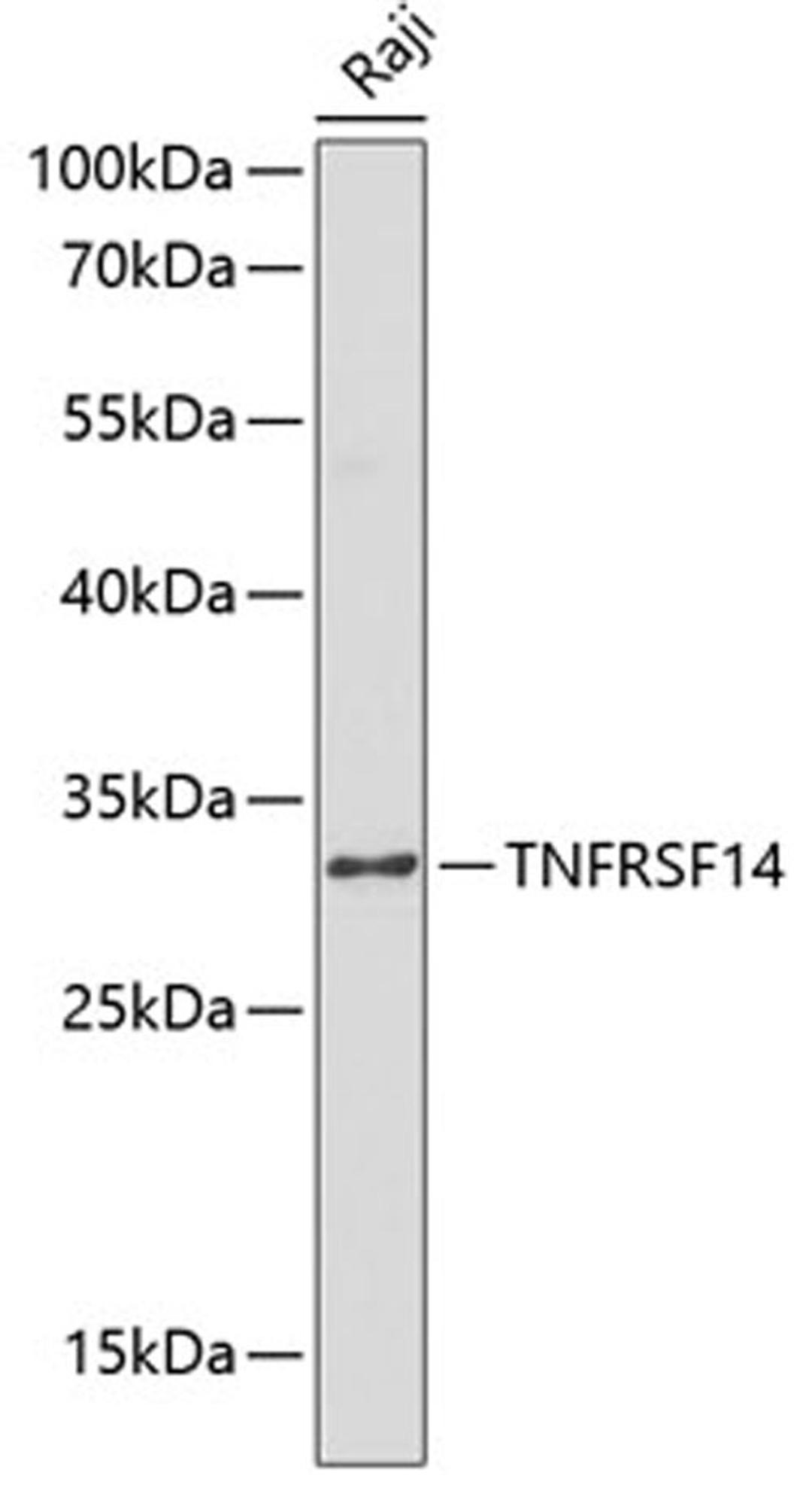 Western blot - HVEM/TNFRSF14 antibody (A1969)