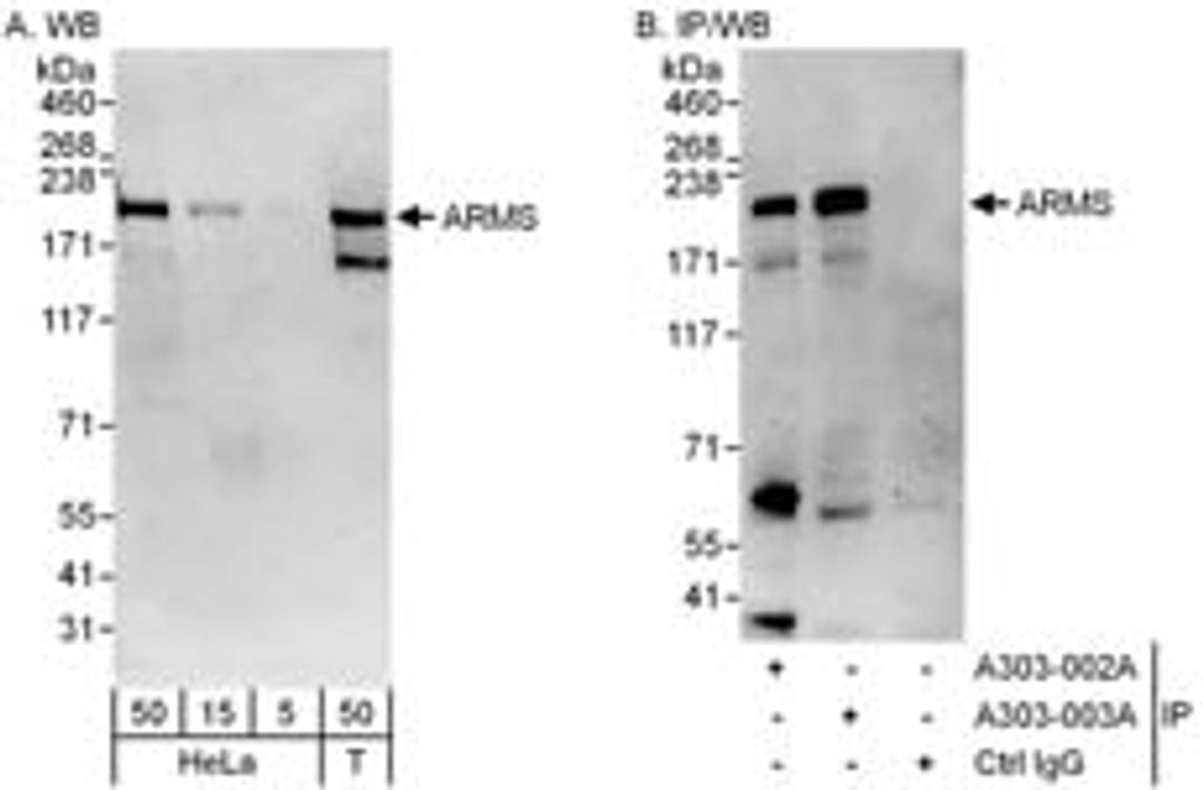 Detection of human ARMS by western blot and immunoprecipitation.