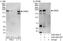 Detection of human ARMS by western blot and immunoprecipitation.