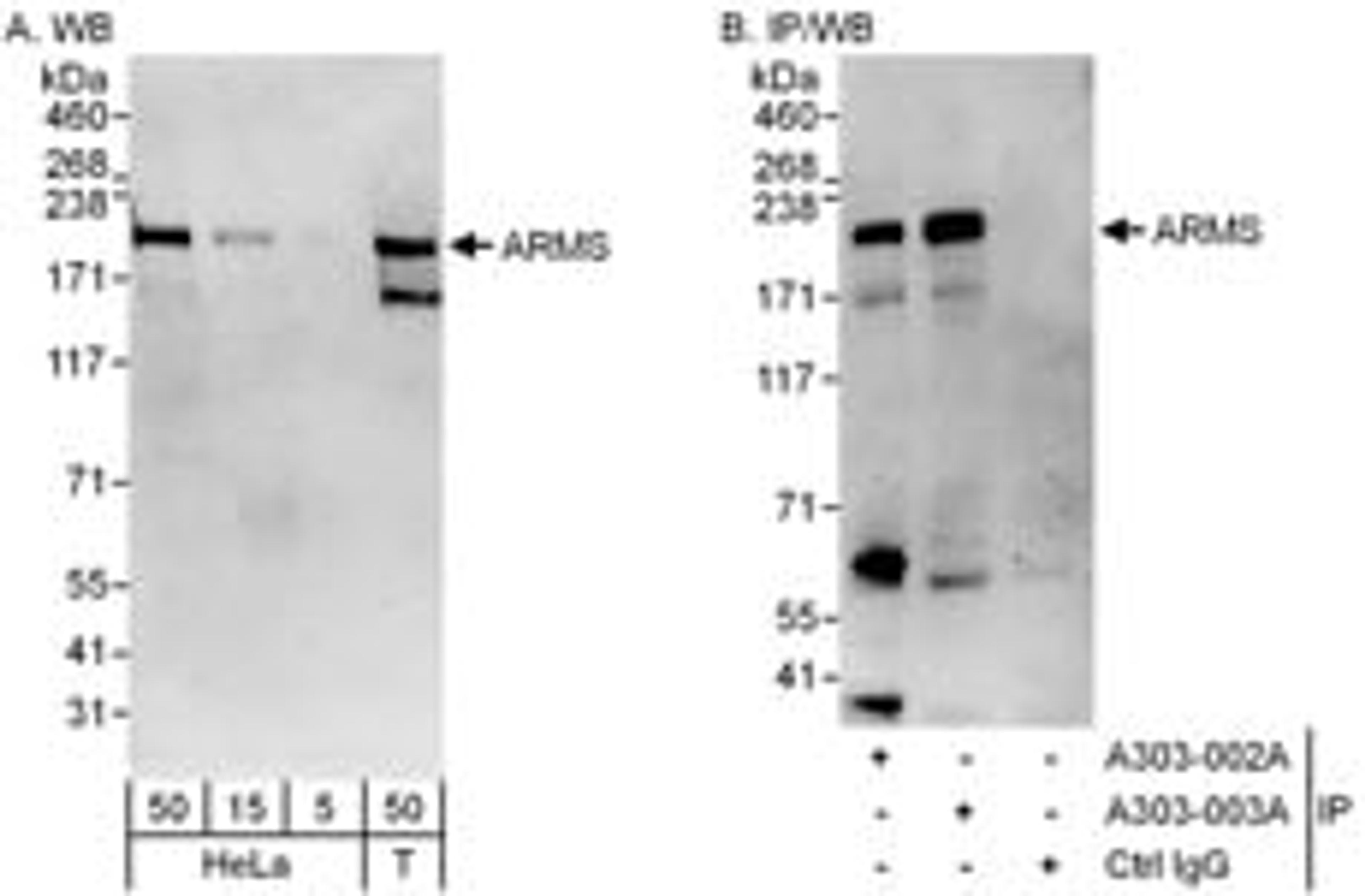 Detection of human ARMS by western blot and immunoprecipitation.