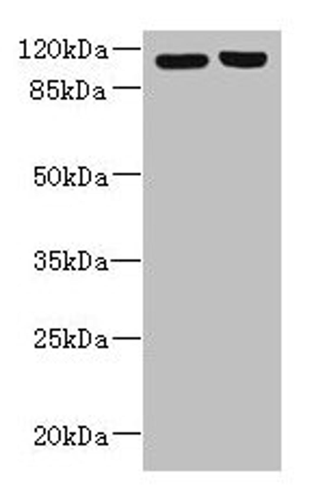 Western blot. All lanes: RPGR antibody at 6µg/ml. Lane 1: 293T whole cell lysate. Lane 2: Hela whole cell lysate. Secondary. Goat polyclonal to rabbit IgG at 1/10000 dilution. Predicted band size: 114, 91, 71, 84, 53, 128 kDa. Observed band size: 114 kDa