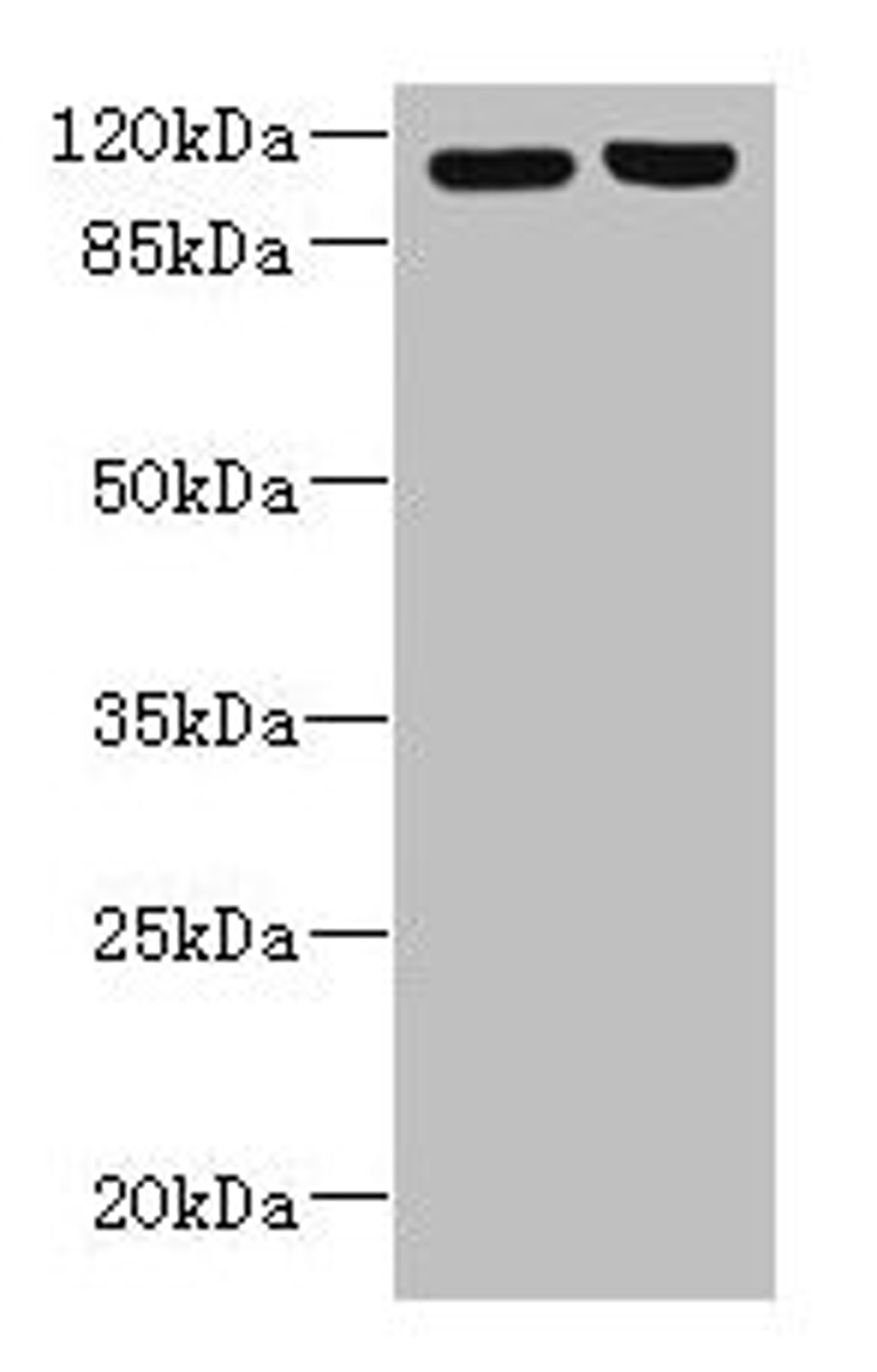 Western blot. All lanes: RPGR antibody at 6µg/ml. Lane 1: 293T whole cell lysate. Lane 2: Hela whole cell lysate. Secondary. Goat polyclonal to rabbit IgG at 1/10000 dilution. Predicted band size: 114, 91, 71, 84, 53, 128 kDa. Observed band size: 114 kDa