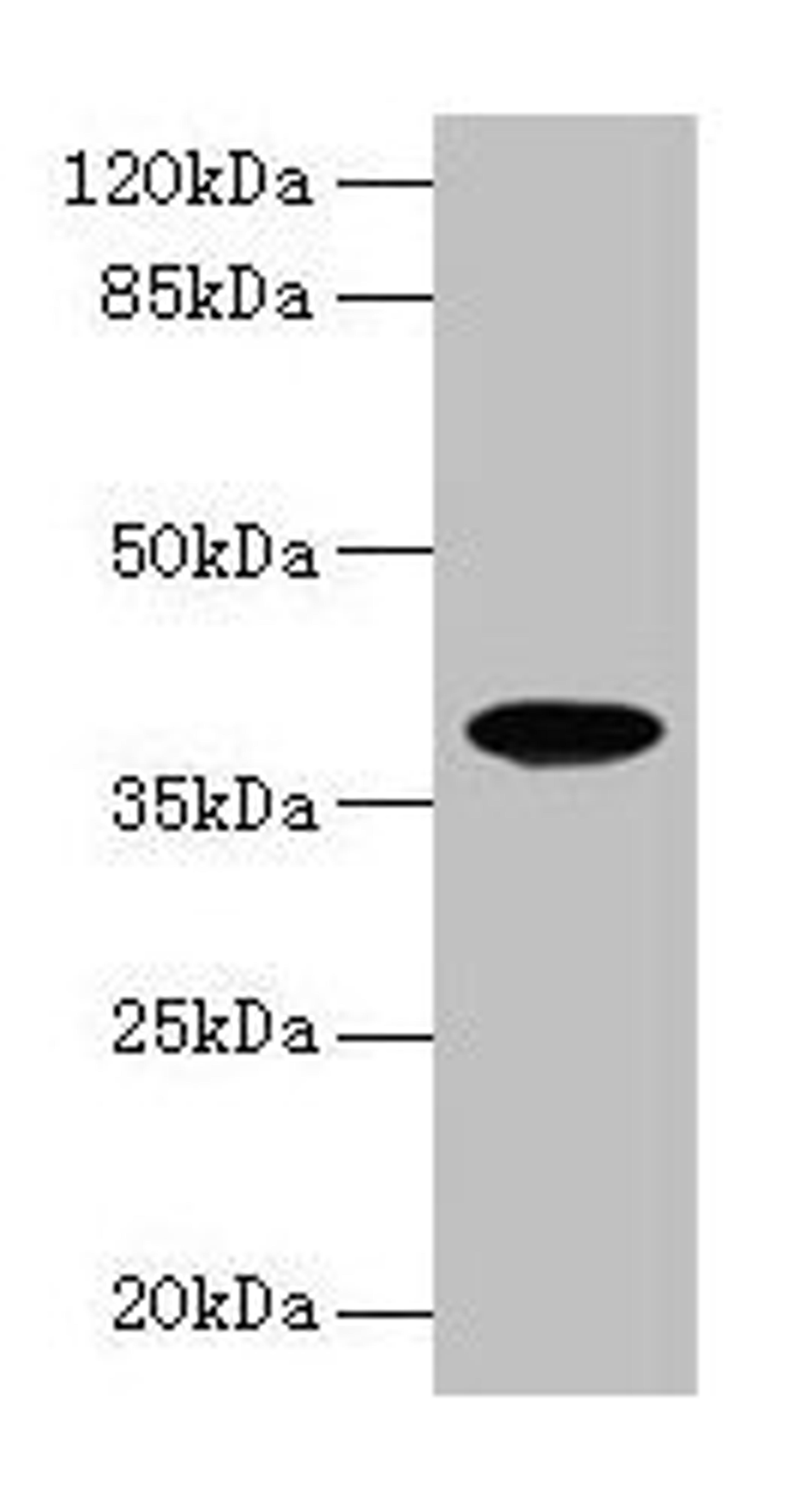 Western blot. All lanes: FPR2 antibody at 8µg/ml + HL60 whole cell lysate. Secondary. Goat polyclonal to rabbit IgG at 1/10000 dilution. Predicted band size: 39 kDa. Observed band size: 39 kDa