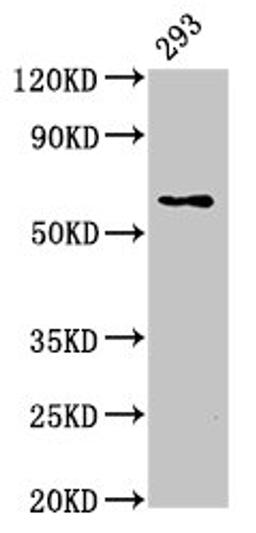 Western Blot. Positive WB detected in: 293 whole cell lysate. All lanes: LPCAT2 antibody at 5ug/ml. Secondary. Goat polyclonal to rabbit IgG at 1/50000 dilution. Predicted band size: 61, 31 kDa. Observed band size: 61 kDa. 