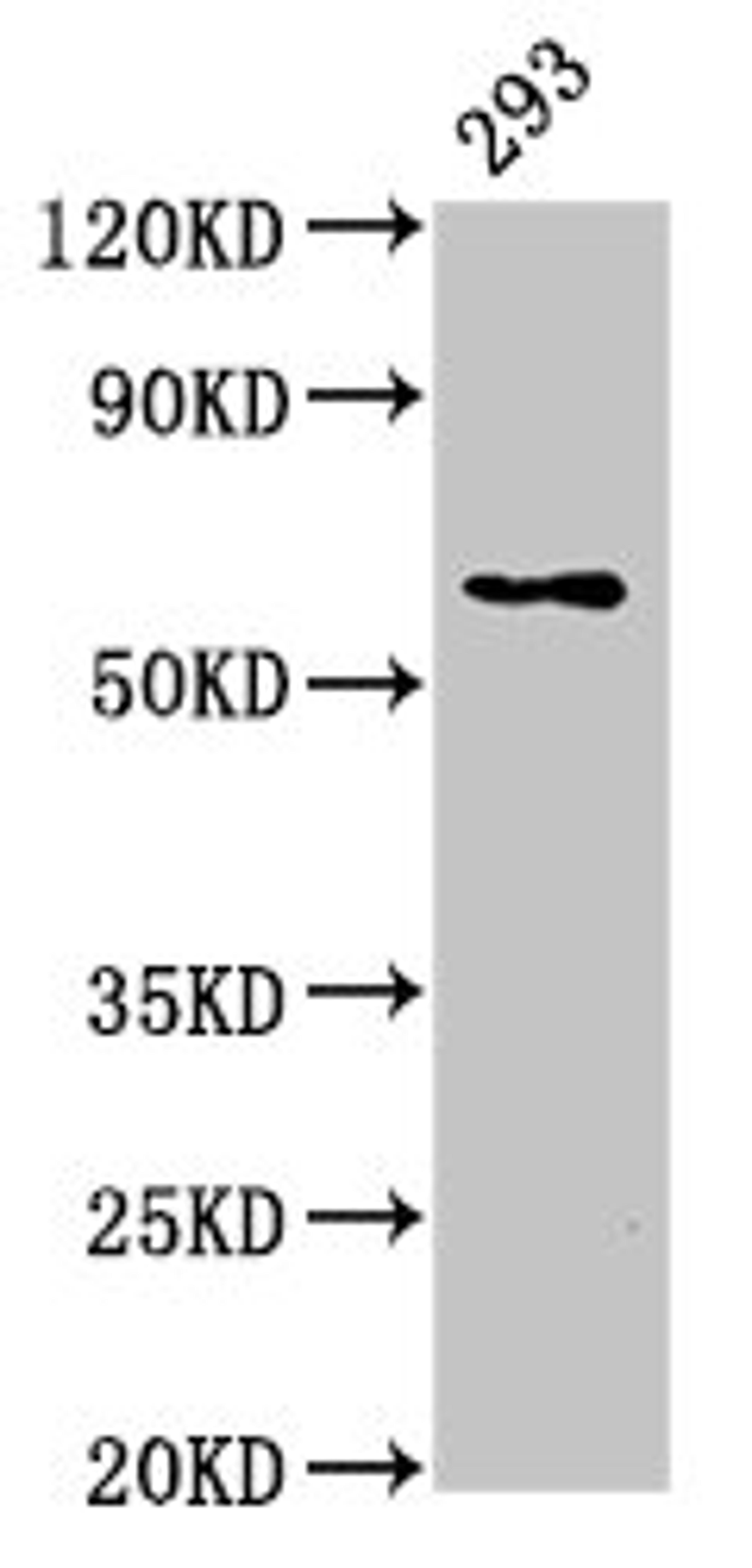 Western Blot. Positive WB detected in: 293 whole cell lysate. All lanes: LPCAT2 antibody at 5ug/ml. Secondary. Goat polyclonal to rabbit IgG at 1/50000 dilution. Predicted band size: 61, 31 kDa. Observed band size: 61 kDa. 