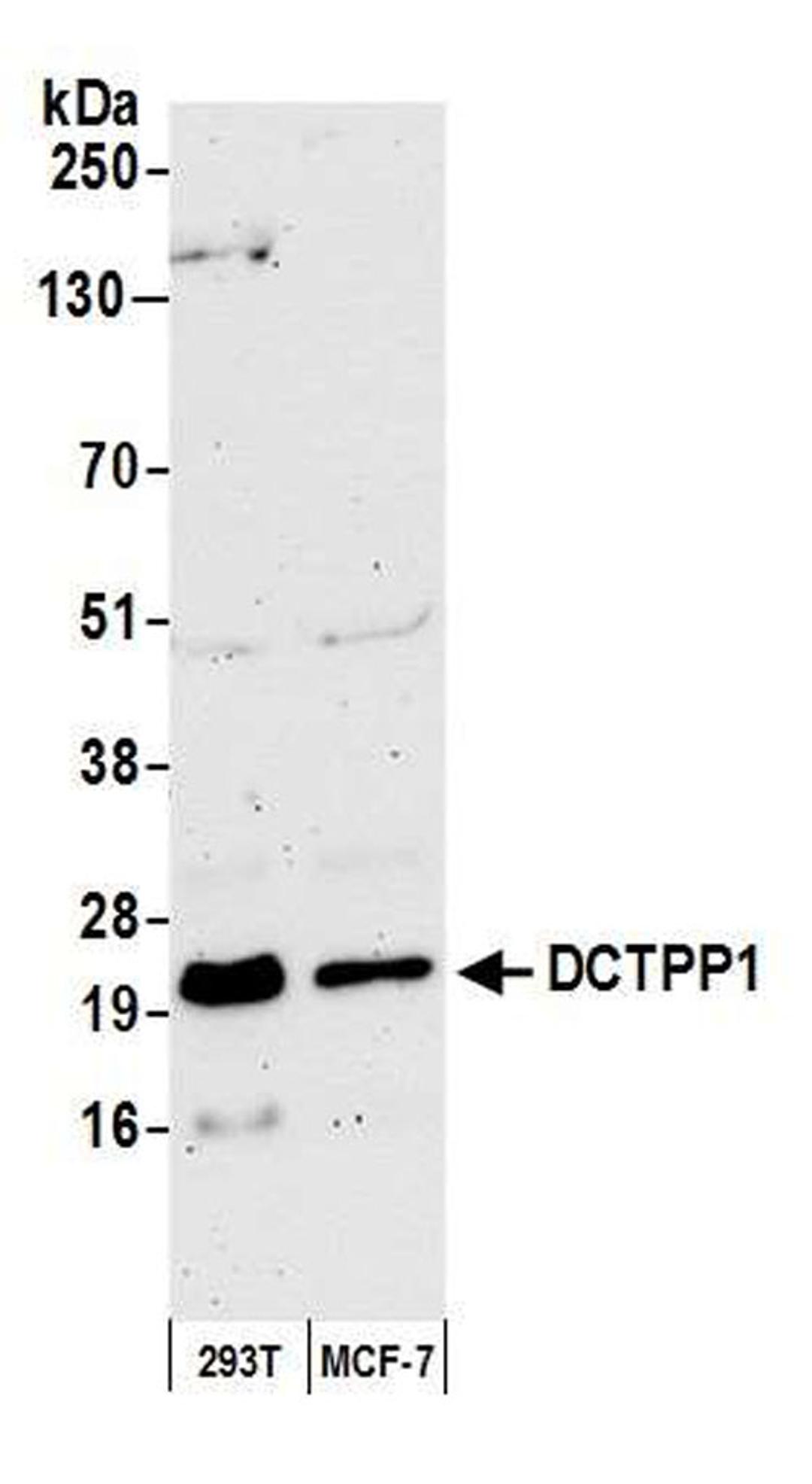 Detection of human DCTPP1 by WB.