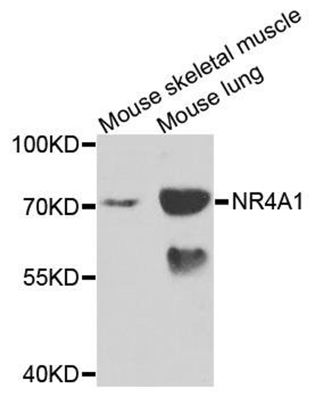 Western blot analysis of extracts of mouse testis using NR4A1 antibody