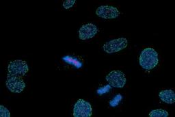 Proximity Ligation Assay: TPR Antibody [NB100-2866] - TPR and Mad1 interaction at the Nuclear Pores (green dots). DNA counterstained with DAPI (blue). Image from verified customer review.