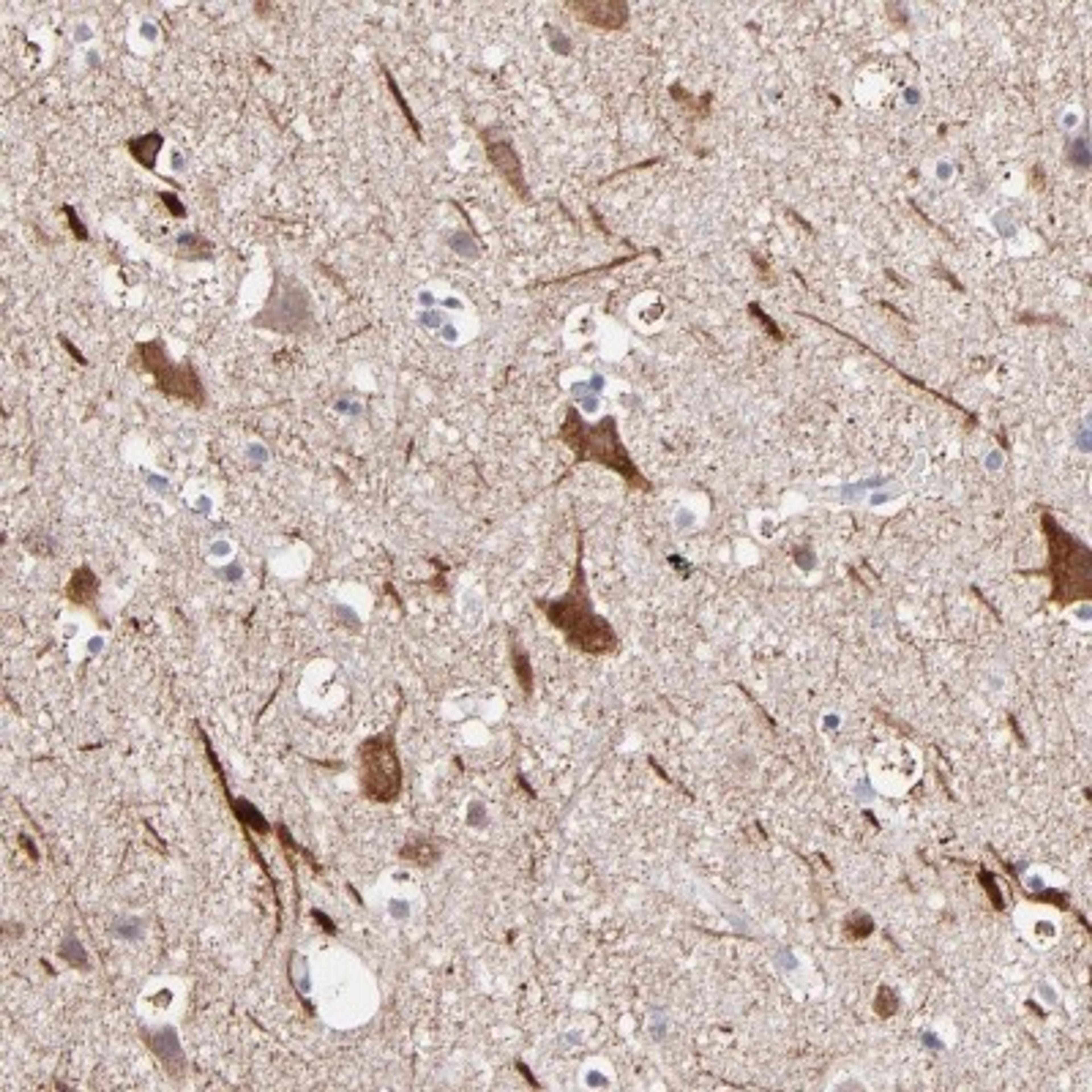 Immunohistochemistry-Paraffin: GLDC Antibody [NBP1-83374] - Staining of human cerebral cortex shows strong cytoplasmic positivity in neuronal cells.