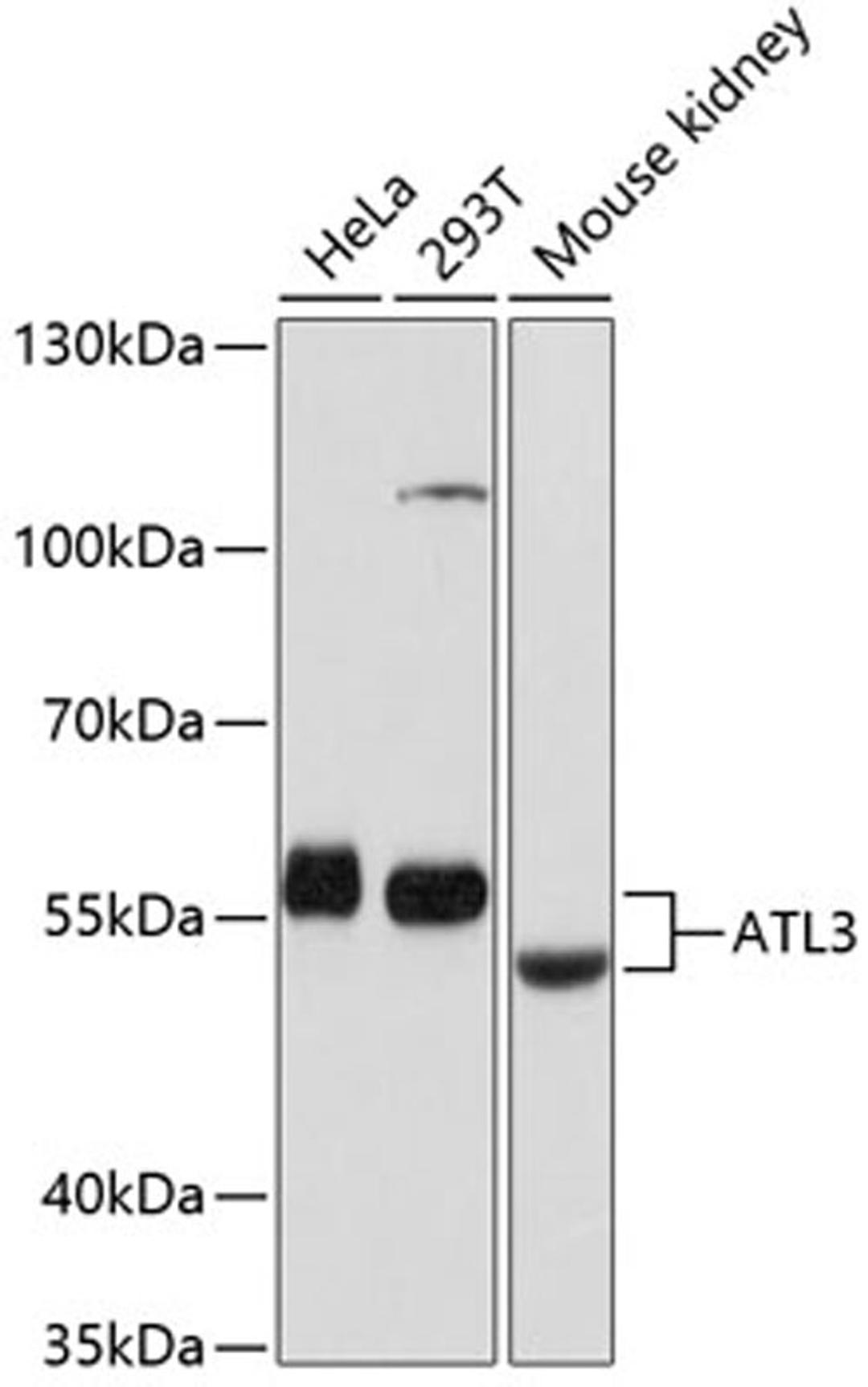 Western blot - ATL3 antibody (A12196)