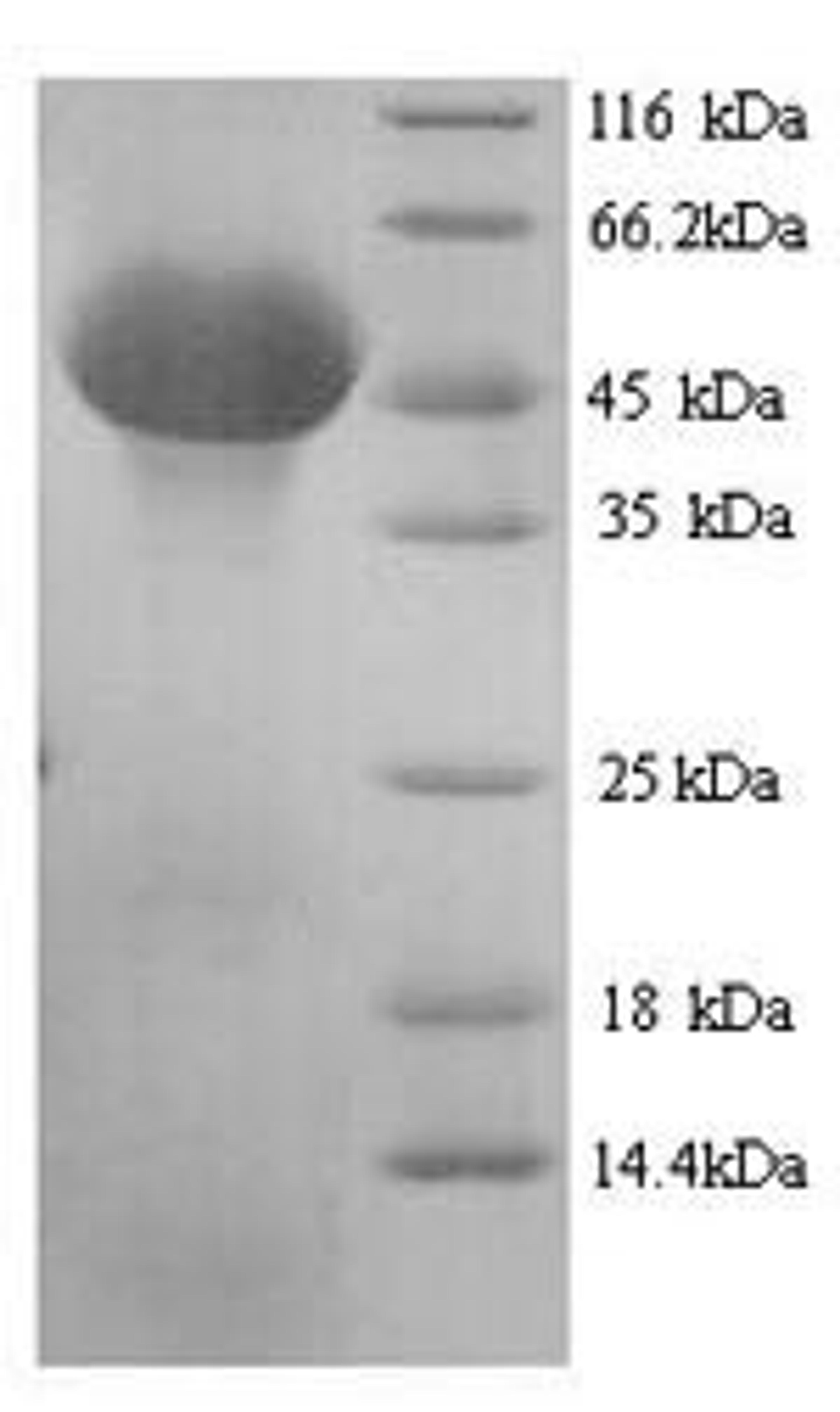 (Tris-Glycine gel) Discontinuous SDS-PAGE (reduced) with 5% enrichment gel and 15% separation gel.