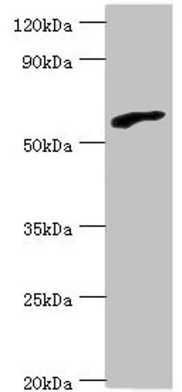 Western blot. All lanes: RBBP5 antibody at 6µg/ml + HepG2 whole cell lysate. Secondary. Goat polyclonal to rabbit IgG at 1/10000 dilution. Predicted band size: 60, 56 kDa. Observed band size: 60 kDa