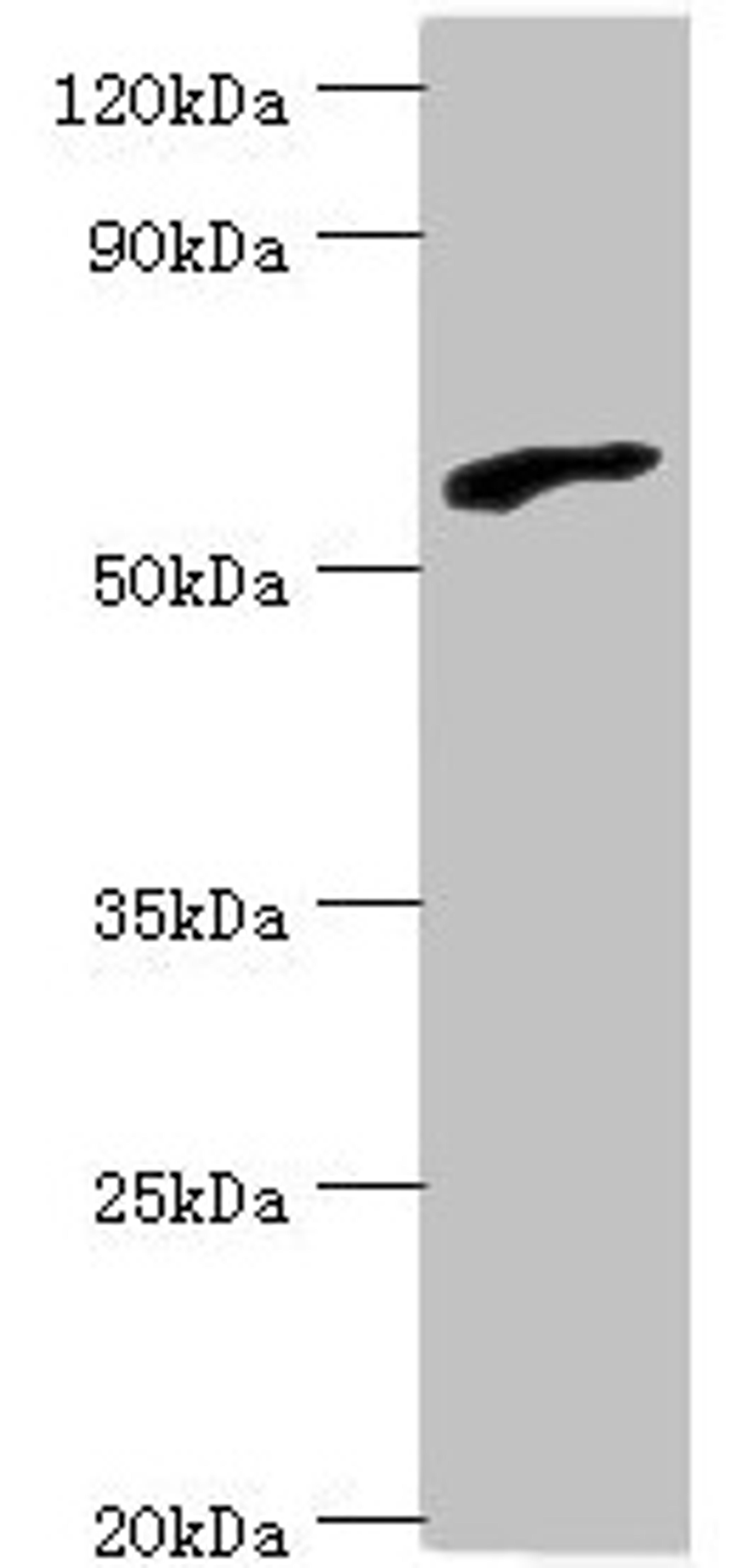 Western blot. All lanes: RBBP5 antibody at 6µg/ml + HepG2 whole cell lysate. Secondary. Goat polyclonal to rabbit IgG at 1/10000 dilution. Predicted band size: 60, 56 kDa. Observed band size: 60 kDa
