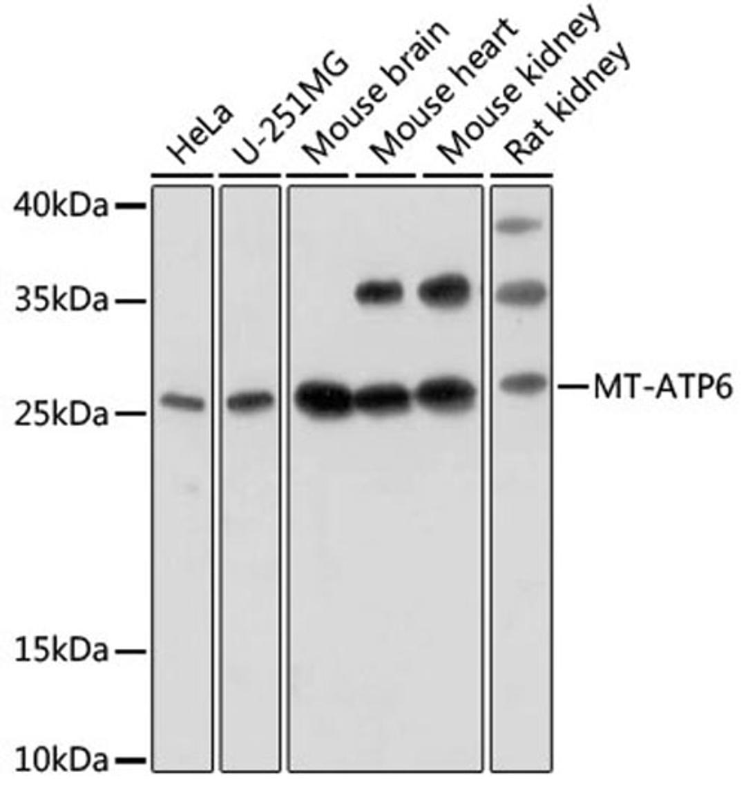 Western blot - MT-ATP6 antibody (A17960)