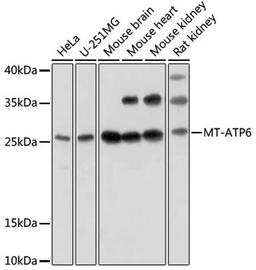 Western blot - MT-ATP6 antibody (A17960)