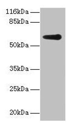 Western blot. All lanes: GK2 antibody at 2µg/ml + Jurkat whole cell lysate. Secondary. Goat polyclonal to rabbit IgG at 1/10000 dilution. Predicted band size: 61 kDa. Observed band size: 61 kDa