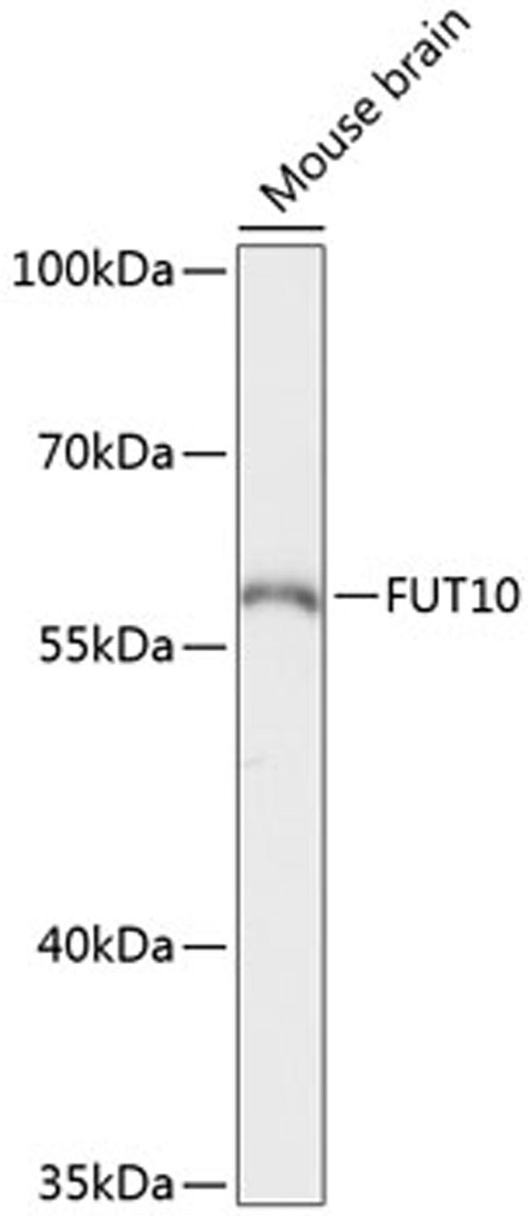 Western blot - FUT10 antibody (A13872)