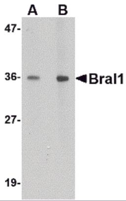 Western blot analysis of BRAL1 in human brain tissue lysate with BRAL1 antibody at (A) 1 and (B) 2 &#956;g/mL.