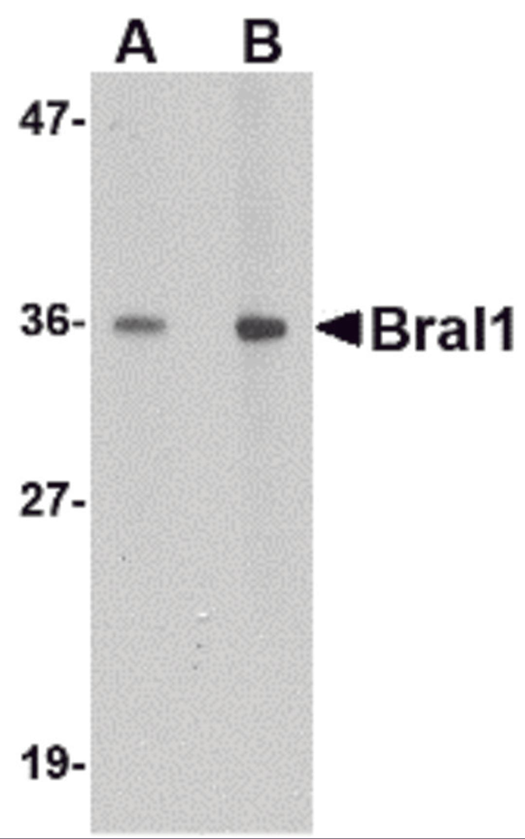 Western blot analysis of BRAL1 in human brain tissue lysate with BRAL1 antibody at (A) 1 and (B) 2 μg/mL.