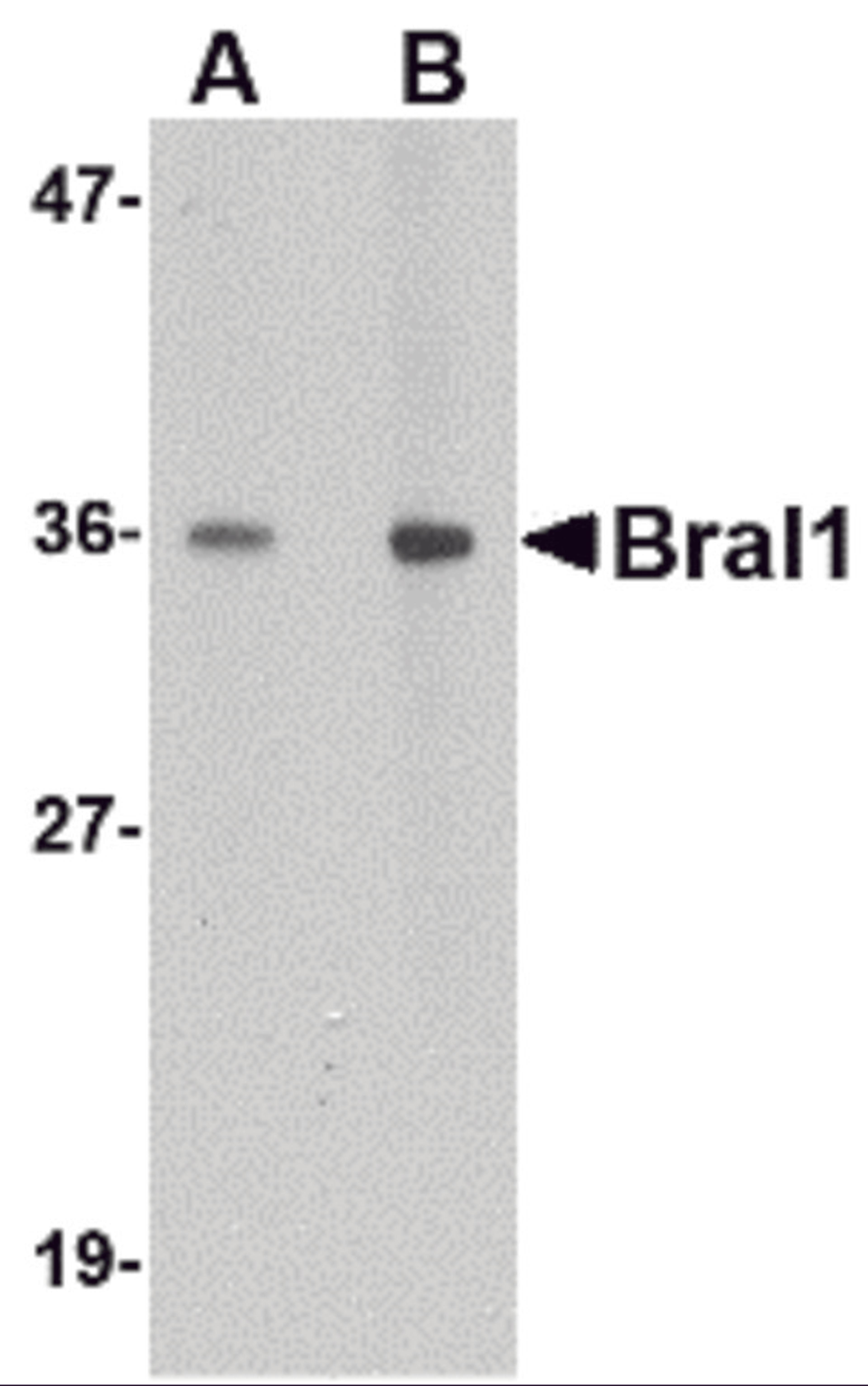 Western blot analysis of BRAL1 in human brain tissue lysate with BRAL1 antibody at (A) 1 and (B) 2 μg/mL.