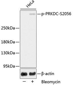 Western blot - Phospho-PRKDC-S2056 antibody (AP0621)