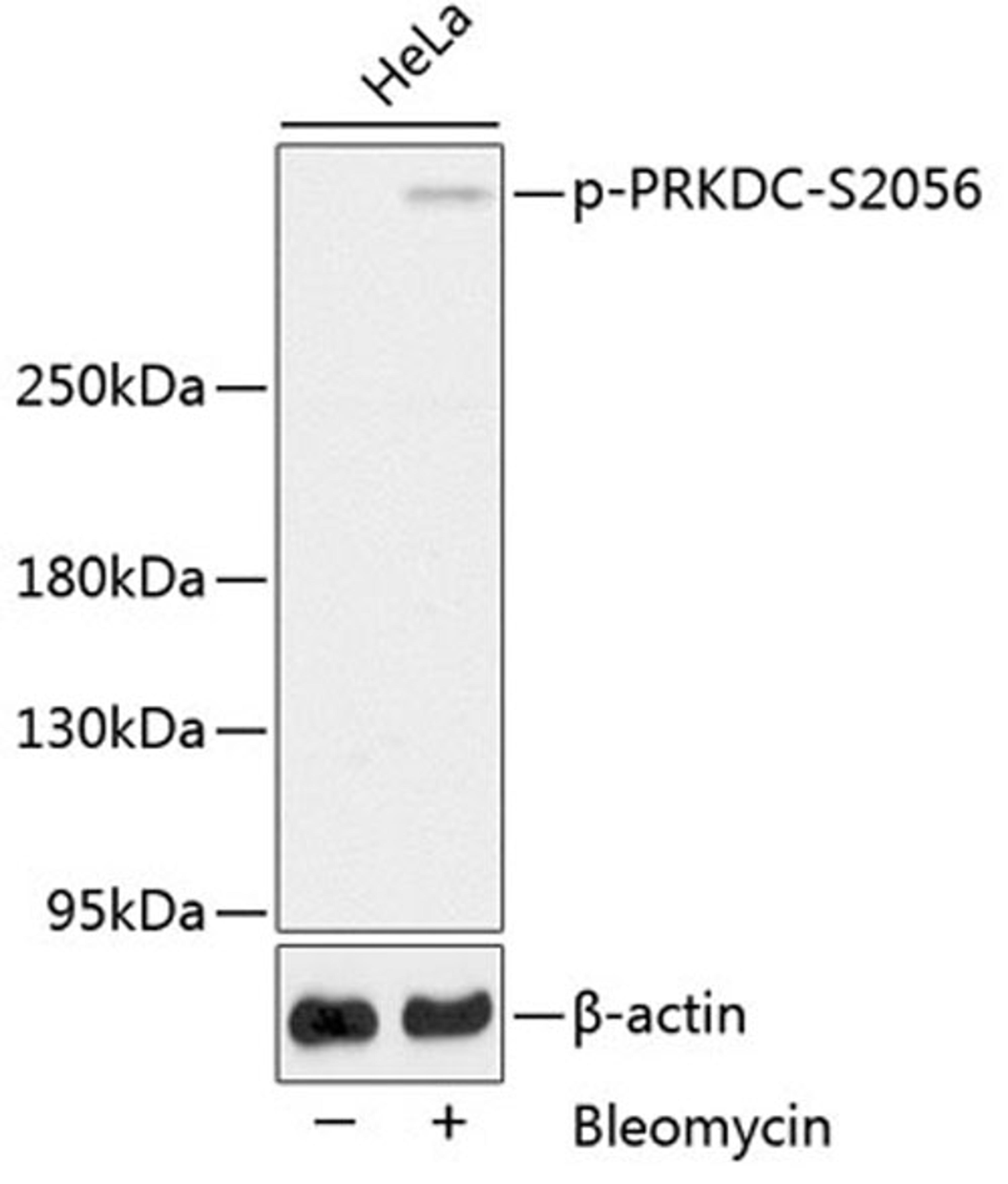 Western blot - Phospho-PRKDC-S2056 antibody (AP0621)