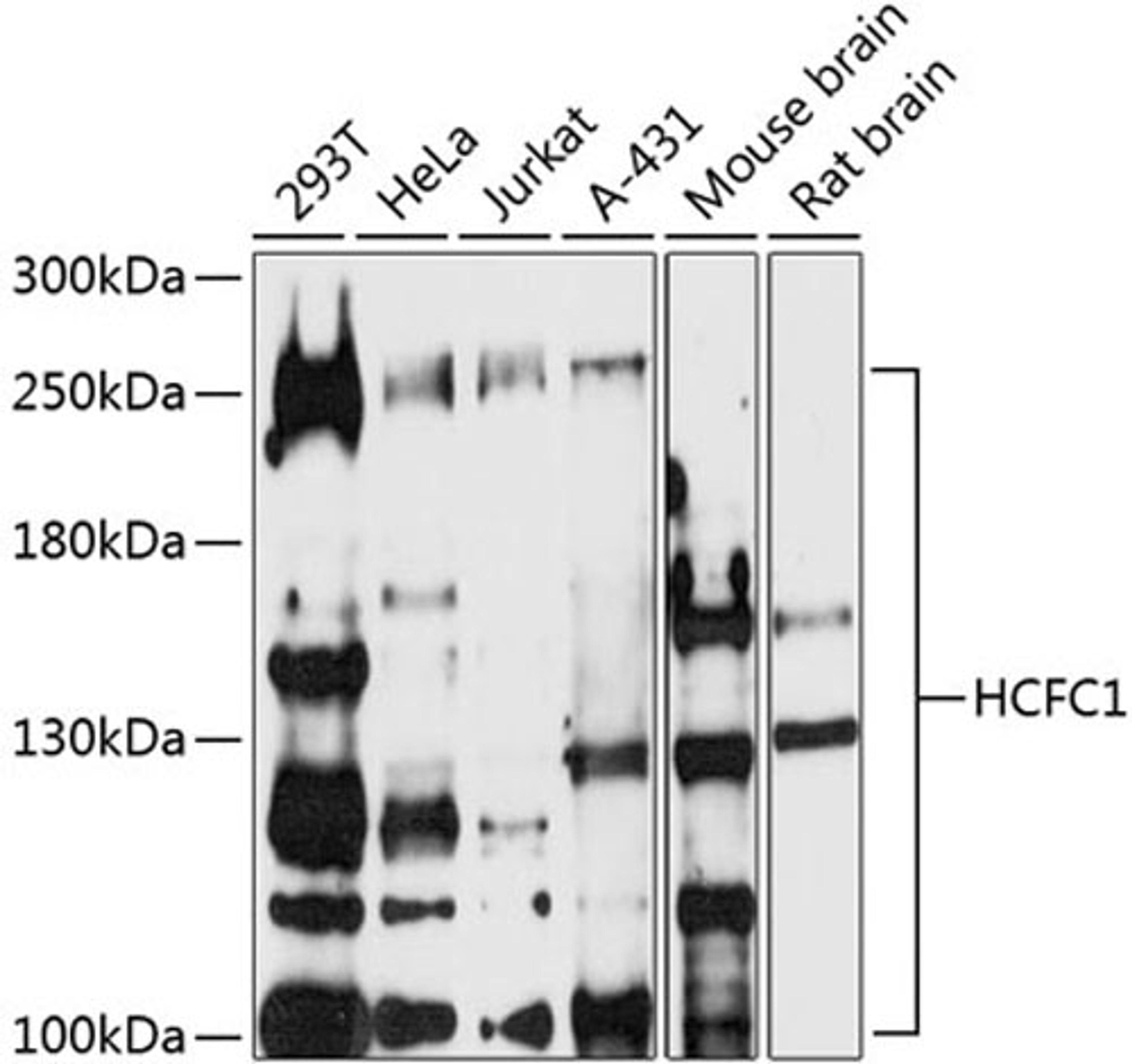 Western blot - HCFC1 antibody (A16871)