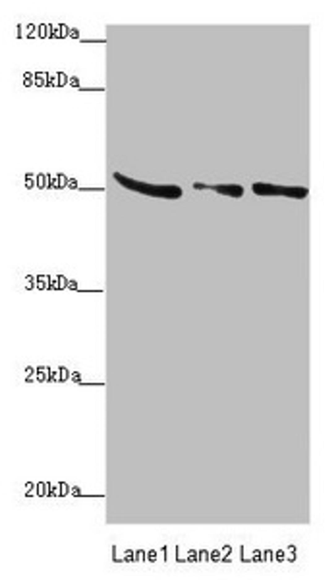 Western blot. All lanes: SUCLA2 antibody at 0.85µg/ml. Lane 1: Rat heart tissue. Lane 2: Hela whole cell lysate. Lane 3: A549 whole cell lysate. Secondary. Goat polyclonal to rabbit IgG at 1/10000 dilution. Predicted band size: 51, 49 kDa. Observed band size: 51 kDa