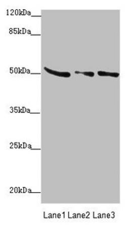 Western blot. All lanes: SUCLA2 antibody at 0.85µg/ml. Lane 1: Rat heart tissue. Lane 2: Hela whole cell lysate. Lane 3: A549 whole cell lysate. Secondary. Goat polyclonal to rabbit IgG at 1/10000 dilution. Predicted band size: 51, 49 kDa. Observed band size: 51 kDa