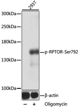 Western blot - Phospho-RPTOR-Ser792 antibody (AP0928)