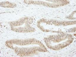 Detection of human SSH3 by immunohistochemistry.