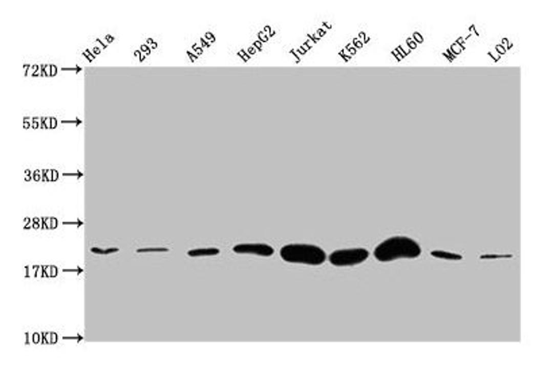 Western Blot. Positive WB detected in: Hela whole cell lysate, 293 whole cell lysate, A549 whole cell lysate, HepG2 whole cell lysate, Jurkat whole cell lysate, K562 whole cell lysate, HL60 whole cell lysate, MCF-7 whole cell lysate, LO2 whole cell lysate. All lanes: HIST1H1E antibody at 1:500. Secondary. Goat polyclonal to rabbit IgG at 1/40000 dilution. Predicted band size: 22 kDa. Observed band size: 22 kDa