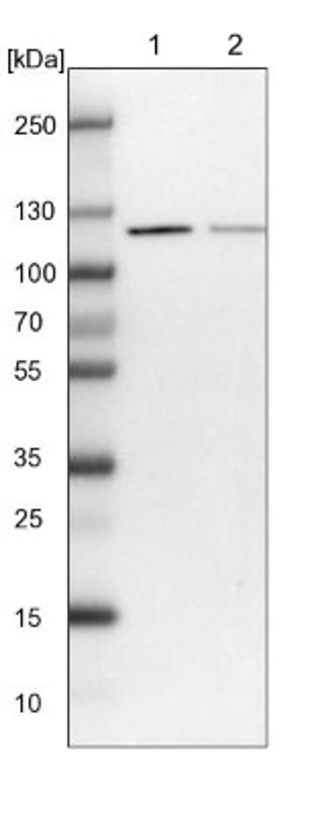 Western Blot: FLJ20097 Antibody [NBP1-88012] - Lane 1: NIH-3T3 cell lysate (Mouse embryonic fibroblast cells)<br/>Lane 2: NBT-II cell lysate (Rat Wistar bladder tumour cells)