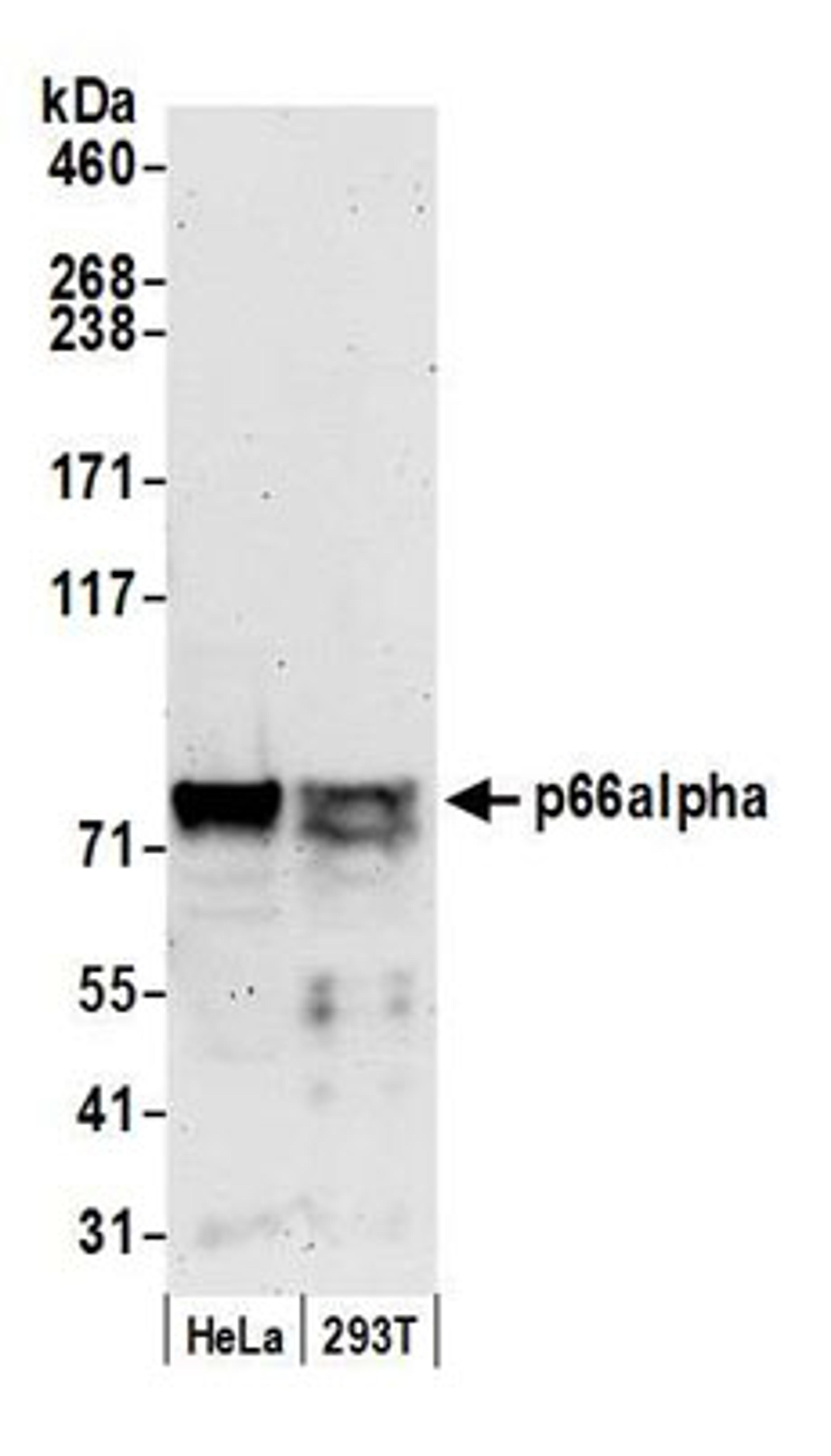 Detection of human p66alpha by western blot.